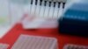 Brazil Declares Health Emergency Amid Avian Flu Cases in Wild Birds