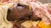 FILE - A severely malnourished child lies on the bed at MSF hospital Bentiu, South Sudan, July 3, 2014.