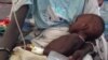 A child is treated for cholera in South Sudan. Malnourishment resulting from the ongoing crisis in the country has left children even more vulnerable to the disease, which has killed 27 people as of June 2, 2014.