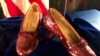 FILE - Ruby slippers once worn by Judy Garland in the "The Wizard of Oz," are displayed at a news conference, Sept. 4, 2018, at the FBI office in Brooklyn Center, Minn.