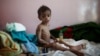 A malnourished boy sits on a bed at a malnutrition treatment center in Sanaa, Yemen, Oct. 30, 2016. 