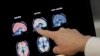 FILE - Dr. William Burke goes over a PET brain scan, Aug. 14, 2018 at Banner Alzheimers Institute in Phoenix, Arizona.