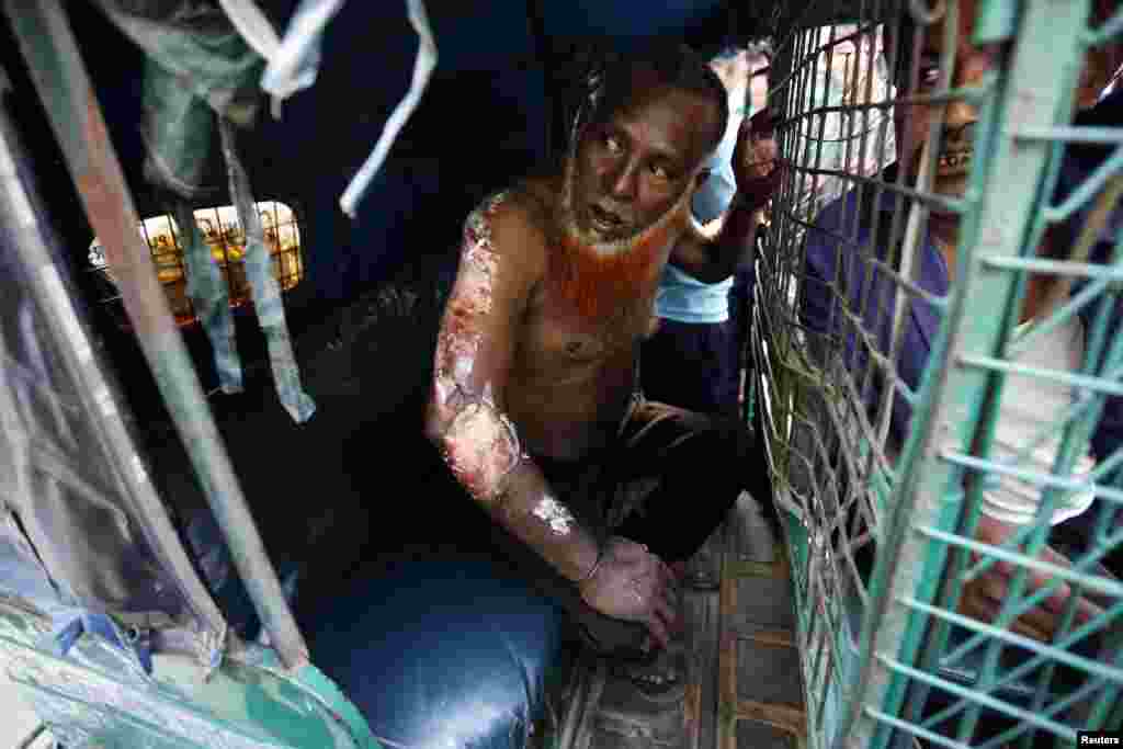 Shamsul Huq, a driver, sits inside his auto rickshaw after his right arm was burned by a crude bomb thrown during a protest against the revised sentencing of Abdul Quader Mollah, Dhaka Sept. 17, 2013.